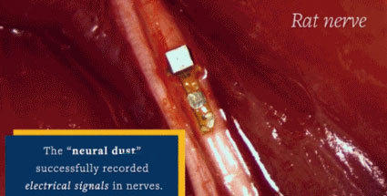 科学家研制体内传感器 可治疗神经病